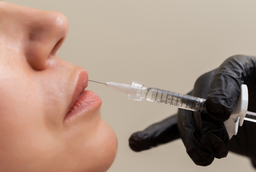 Injectable_Hyaluronic_Fillers